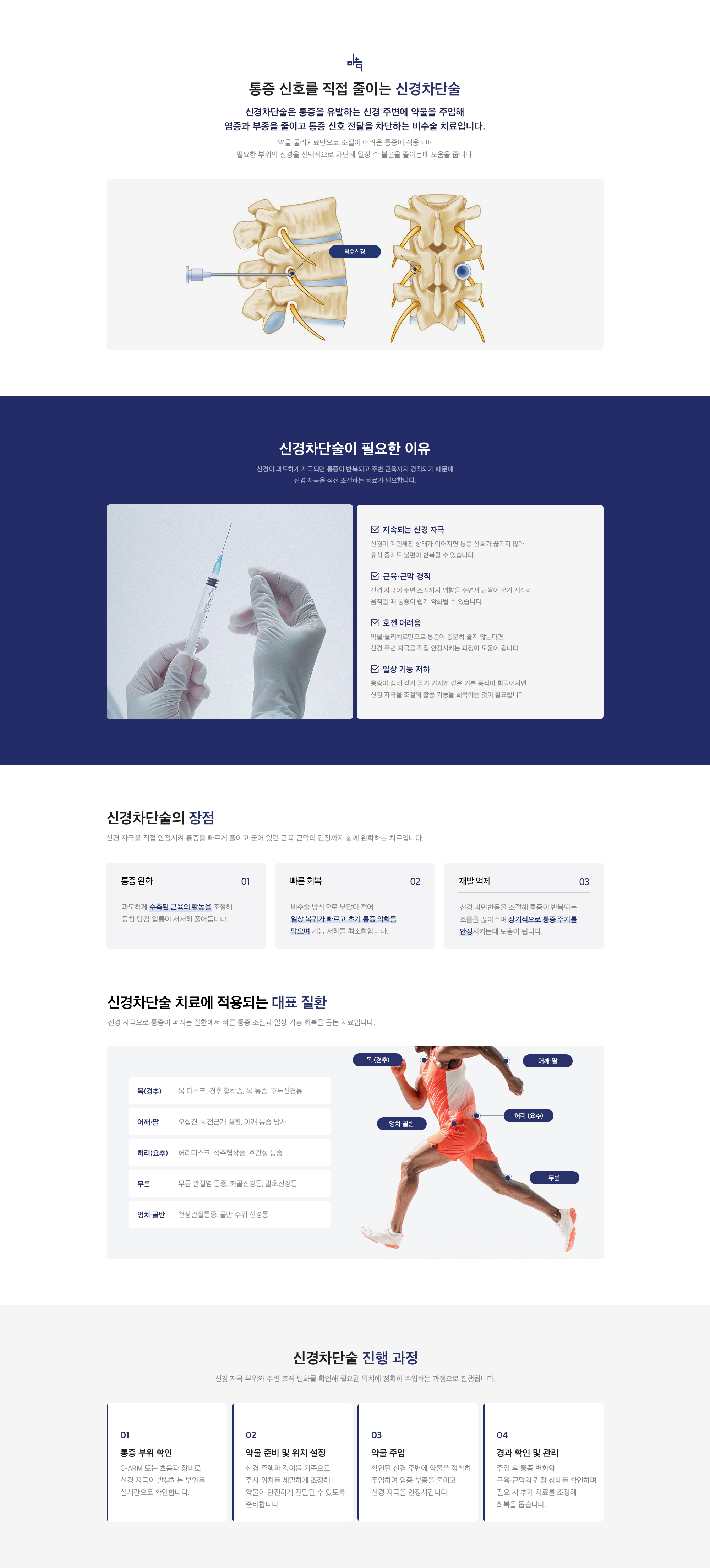 신경차단술